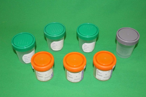 [PMM-017] Urine Sample Cups